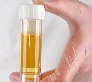 premiertox_step_by_step_urine_collection_and_testing_process