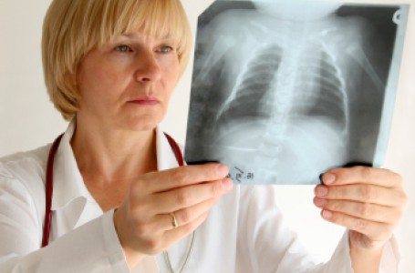 cough_chest_xray