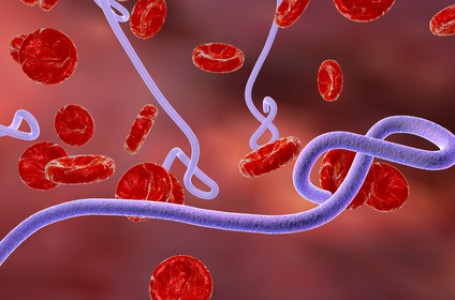 Ebola je vysoce nebezpečné infekční virové onemocnění, které se projevuje krvácivou horečkou Ebola je vysoce nebezpečné infekční virové onemocnění, které se projevuje krvácivou horečkou