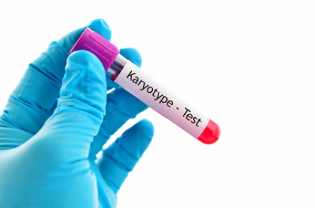 Vyšetření karyotypu je jedním ze způsobů, jak je možné Turnerův syndrom odhalit. Vyšetření karyotypu je jedním ze způsobů, jak je možné Turnerův syndrom odhalit.