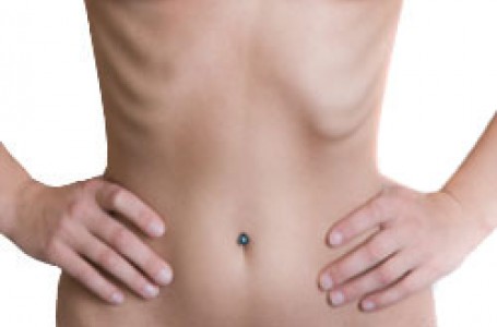 Malnutrice neboli podvýživa Malnutrice neboli podvýživa