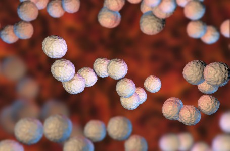 Spálu způsobuje bakterie Streptococcus pyogenes Spálu způsobuje bakterie Streptococcus pyogenes
