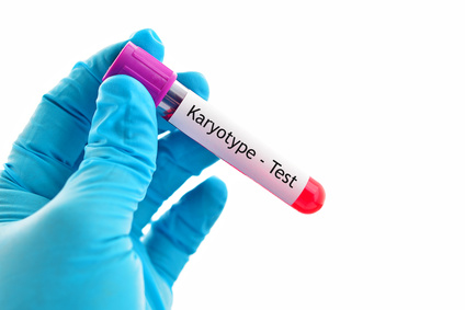 Vyšetření karyotypu je jedním ze způsobů, jak je možné Turnerův syndrom odhalit.